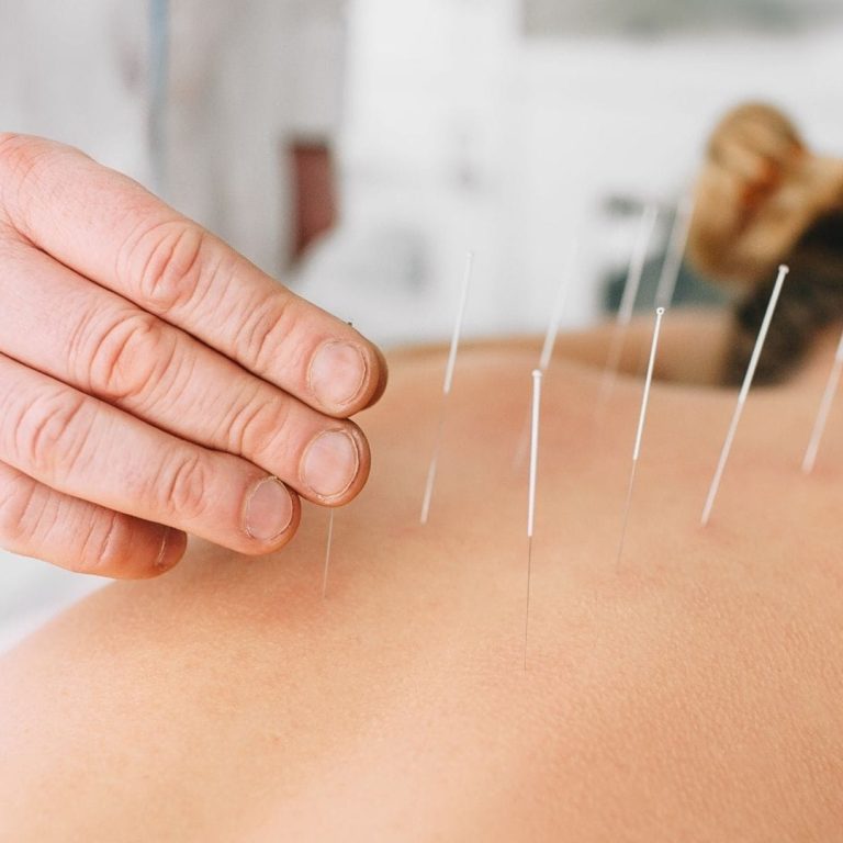 holistic-medicine-blog-akupunktur-bedenin-kendi-sifasini-uyandirmak